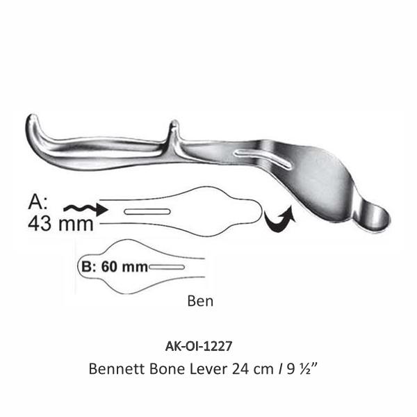 Bennett Bone Lever